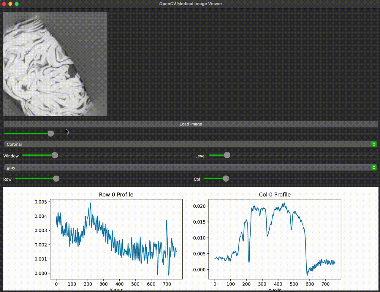 3D view of Cabbage CT