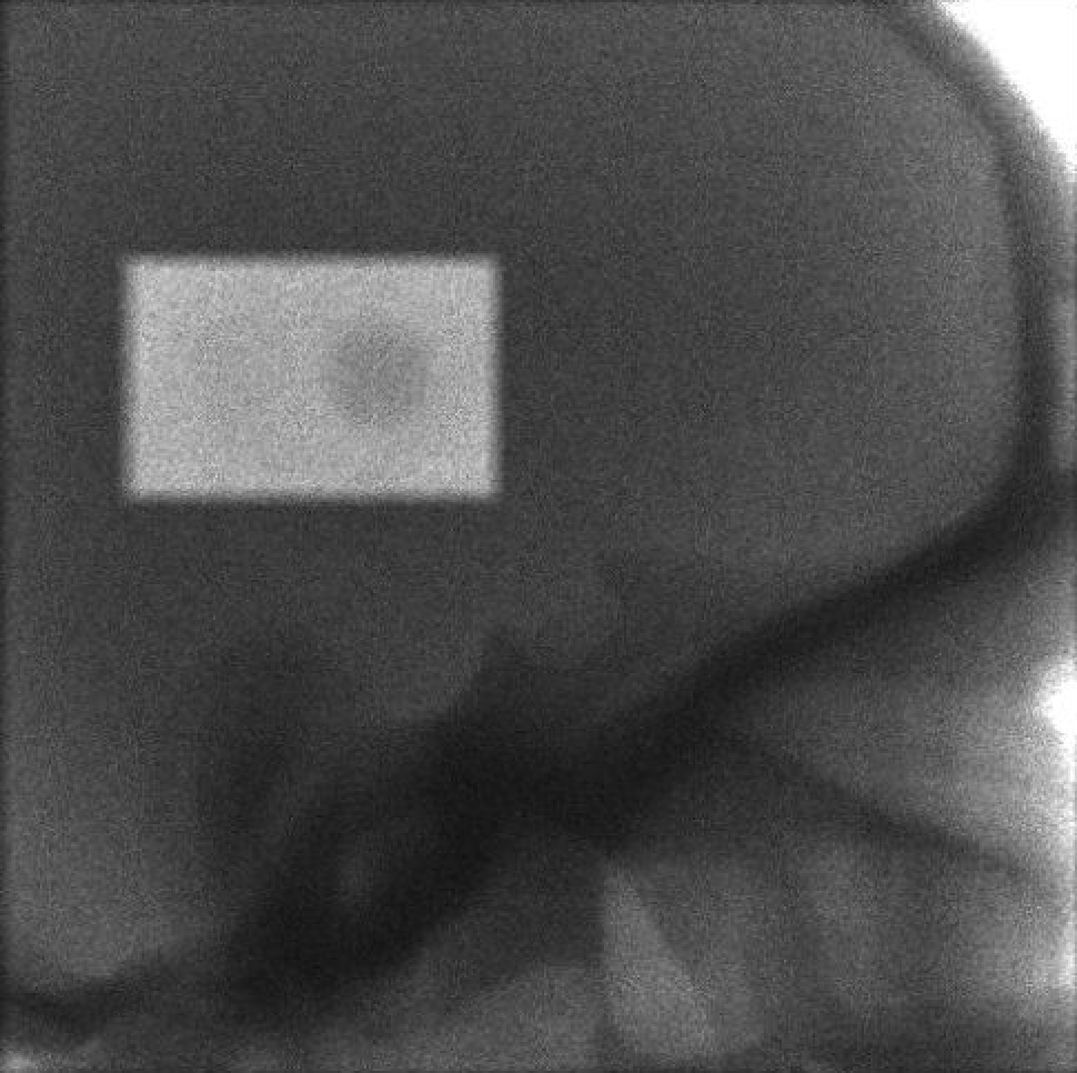 Simulated FFM-CBCT head phantom