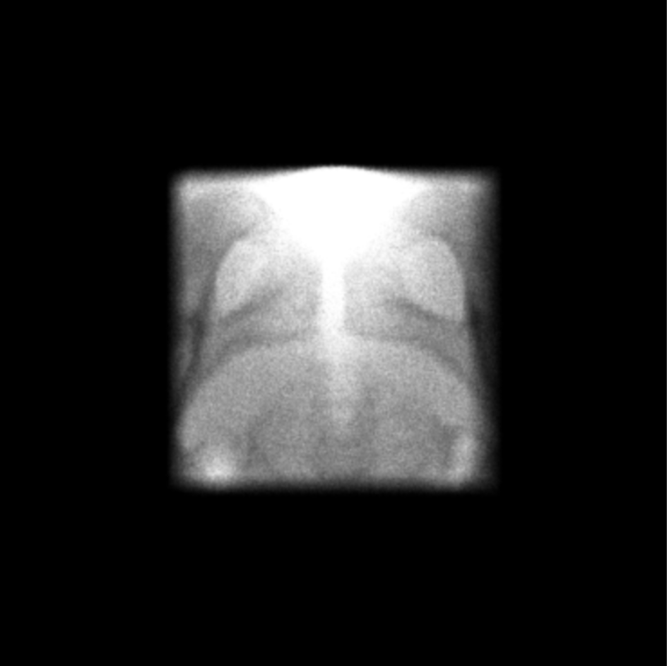 Detector FFM dark region